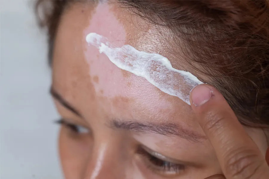 How To Use Camouflage Cream To Effectively Hide Scars?