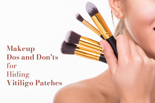 Makeup Do’s and Don’ts for Hiding Vitiligo Patches