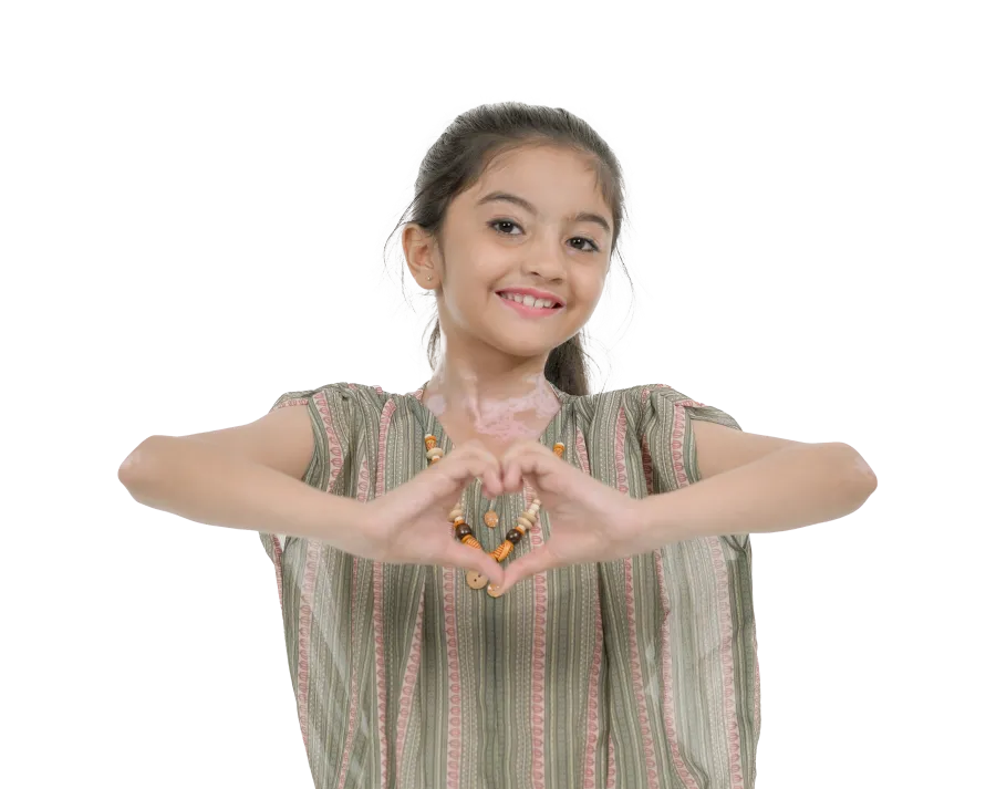 Happy vitiligo girl