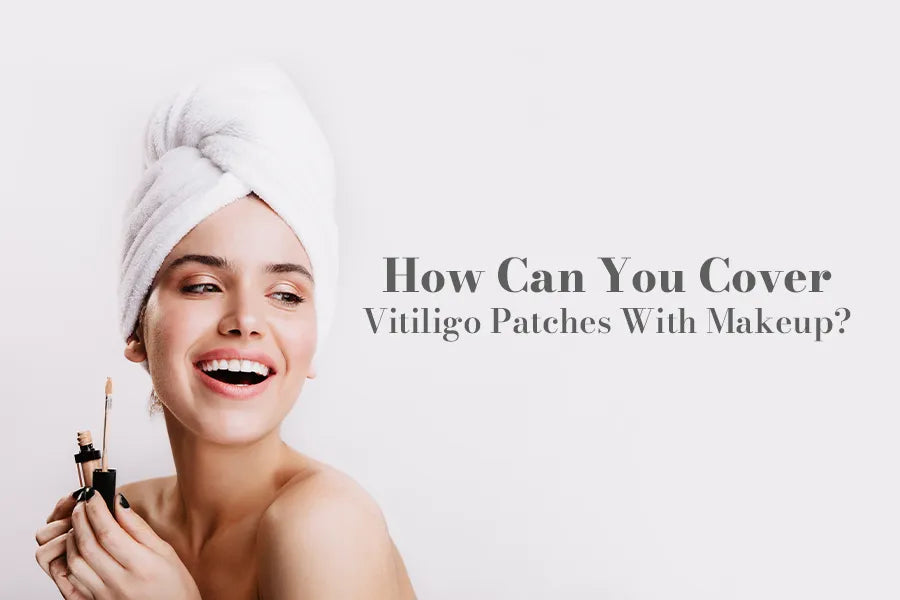 How Can You Cover Vitiligo Patches With Make Up?