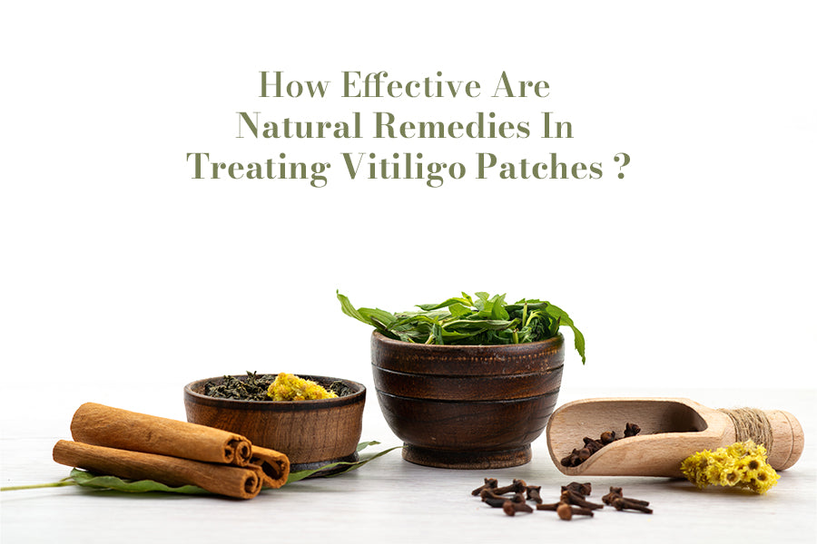 How Effective Are Natural Remedies In Treating Vitiligo Patches?