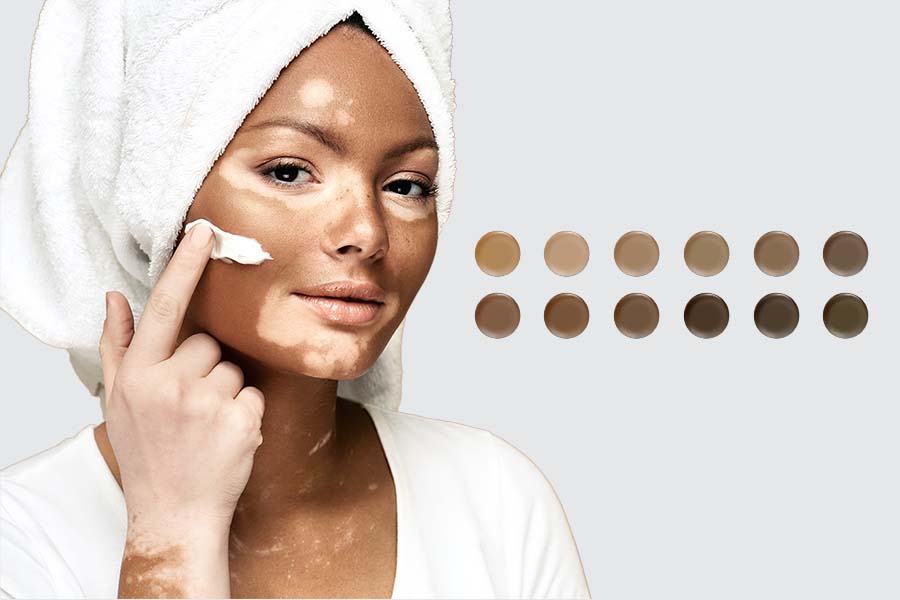 How to Match Your Vitiligo Concealer with Your Skin Tone?