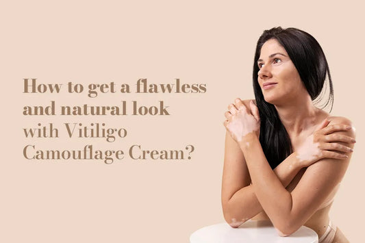 How To Get A Flawless And Natural Look With Vitiligo Camouflage Cream?