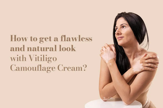 How To Get A Flawless And Natural Look With Vitiligo Camouflage Cream?