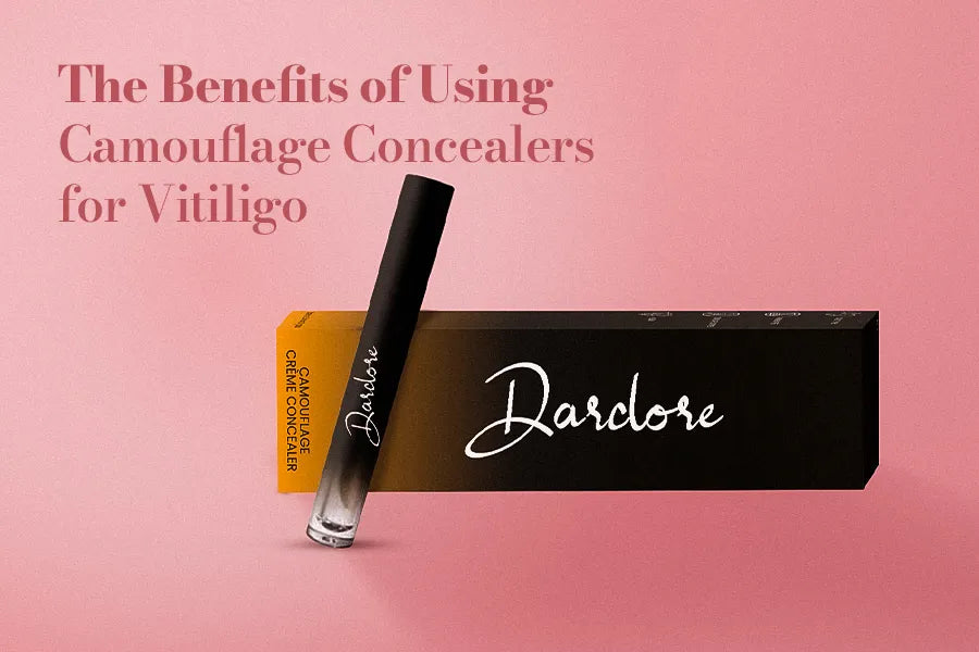 The Benefits of Using Camouflage Concealers for Vitiligo