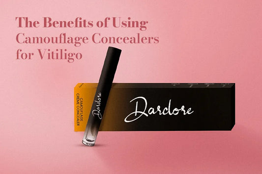 The Benefits of Using Camouflage Concealers for Vitiligo