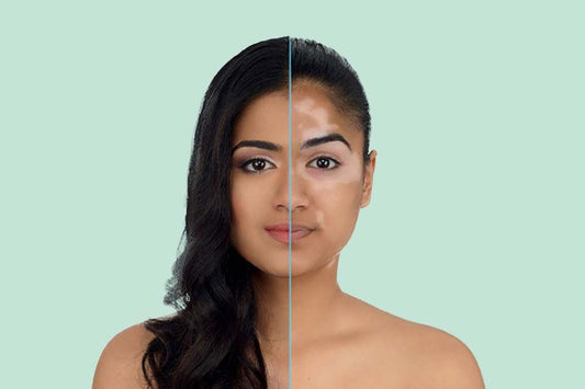 What Are the Benefits Of Using Camouflage Powder For Vitiligo?