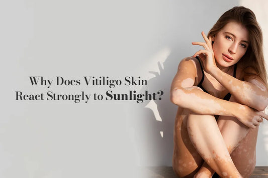 Why Does Vitiligo Skin React Strongly to Sunlight?